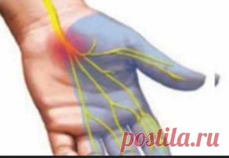 Лечение полинейропатии