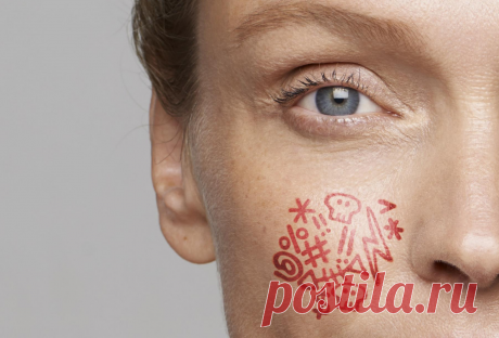 Купероз: причины, симптомы, лечение и профилактика