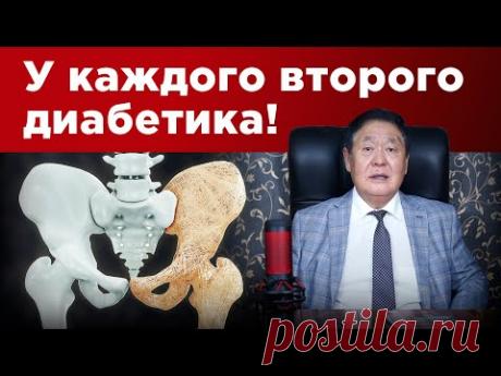 Спасаем хрупкие кости! Остеопороз у диабетика