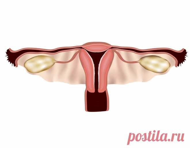 Лечение эрозии шейки матки в Германии