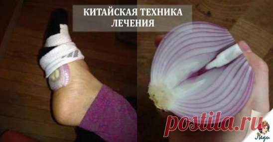 КИТАЙСКАЯ МЕТОДИКА ЛЕЧЕНИЯ ЛУКОМ 
По мнению древнекитайской медицины, на ногах человека расположено огромное количество нервных окончаний, которые связаны со всеми внутренними органами. 
К сожалению, в современном обществе энергия ци в ступнях остается пассивной, потому что люди всегда носят обувь. Но можно научиться правильно стимулировать внутреннюю энергию и избавить себя от уже приобретенных, а также возможных болезней. И поможет обычный репчатый лук. 
 
Лук - одим из самых здоровых овощей