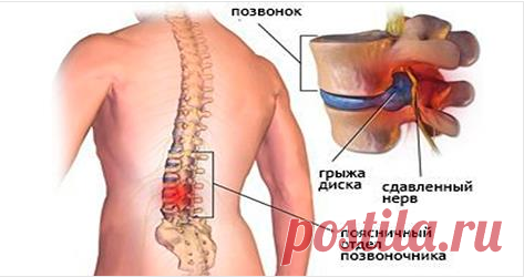 Этот простой секрет избавит от боли в спине, ногах, коленях и ступнях всего за 5 минут! Результаты вы почувствуете сразу! Смотрите как это просто!