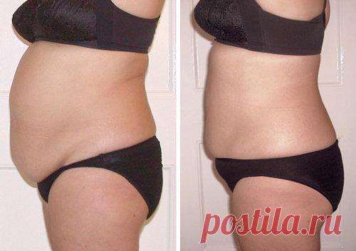 Самая лучшая диета от жира на животе и жиросжигающее домашнее средство: минус 12 кг за 22 дня | Худеем вместе | Яндекс Дзен