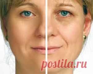 МАЗИ ПРОТИВ МОРЩИН - ДЁШЕВО И ЭФФЕКТИВНО.