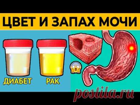 О чем расскажут ЦВЕТ и ЗАПАХ МОЧИ? Срочно проверьте свою МОЧУ! Сигналы серьезных болезней!