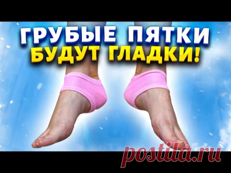 Мои пятки стали как у "младенца". Всего 1 ингредиент, который поможет убрать грубую кожу на ногах.