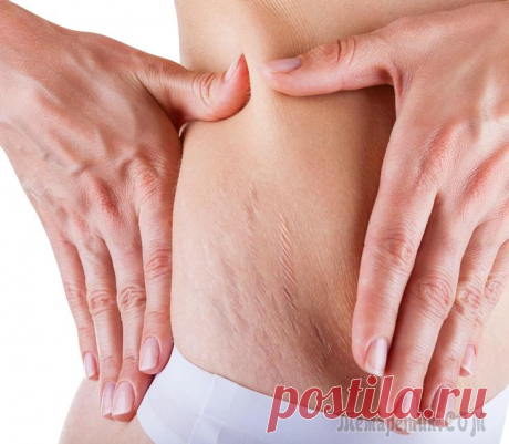 Мумие от растяжек - применение в домашних условиях Растяжки – коварные враги любой женщины, которые появляются легко, а исчезать не торопятся. Существует множество современных средств, которые помогают бороться с этой напастью. Большинство из них изго...