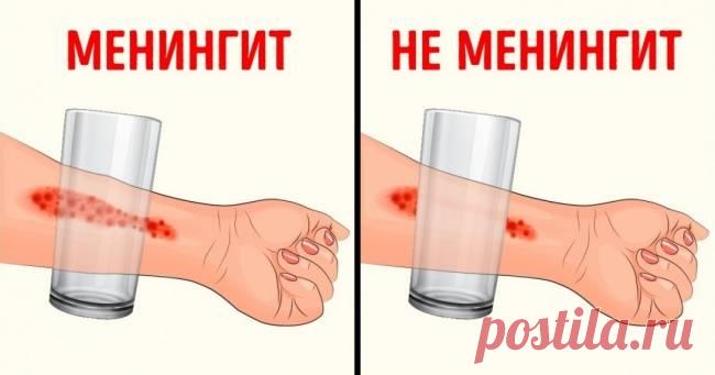 8 симптомов менингита, о которых должен знать каждый родитель Менингит — это заболевание, связанное с воспалением оболочек головного и спинного мозга. Этиология этой болезни может быть разной, но симптомы у различных видов, как правило, схожи. Считается, что наиболее подвержены этой болезни дети. Поэтому 365NEWS решили напомнить родителям о том, как распознать у ребенка менингит и на какие симптомы следует обратить внимание в первую очередь. Внезапная лихорадка       Одним...