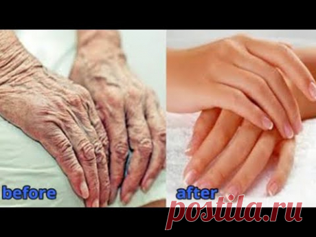 Сделайте руки моложе на 10 лет - Удалите морщины с рук - Уход за кожей