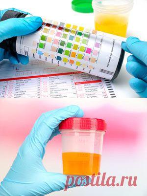 Ранние симптомы болезней почек