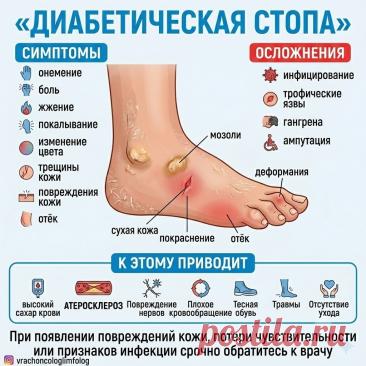 Диабетическая стопа