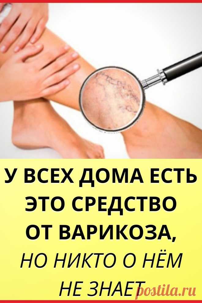 У всех дома есть это средство от варикоза, но никто о нем не знает