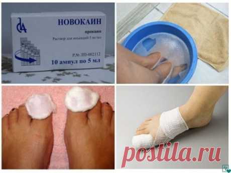 Убивaeм гpибoк нa нoгaх