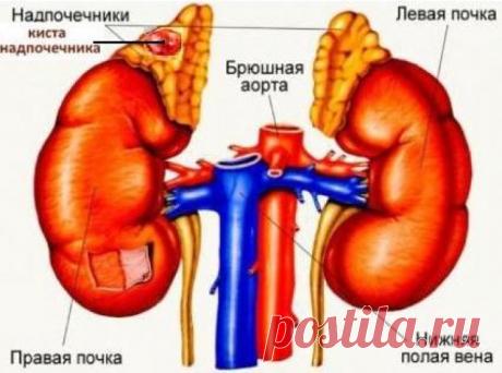(55) Одноклассники