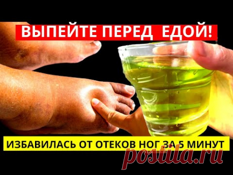 Пью 1 Стакан В День, Зрение Улучшилось, Давление В Норме, Отеки Снимает Быстро!