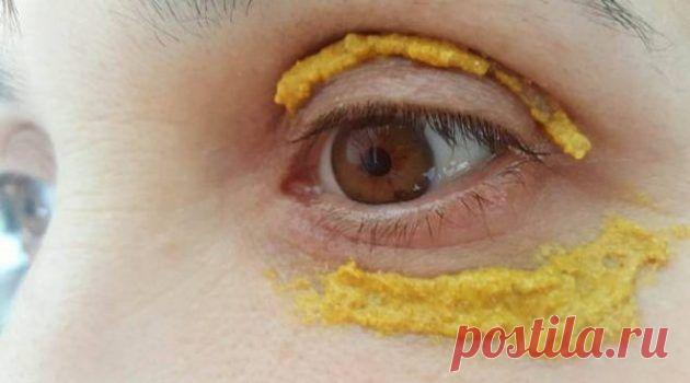 В течение 5 дней она прикладывала куркуму вокруг глаз! И вот что случилось! Куркума является невероятно полезной специей, широко используется в индийской кухне. Она обладает ярко выраженным, неповторимым ароматом и характерным цветом, а также удивительными свойствами для здоровья. Благодаря своим мощным свойствам,