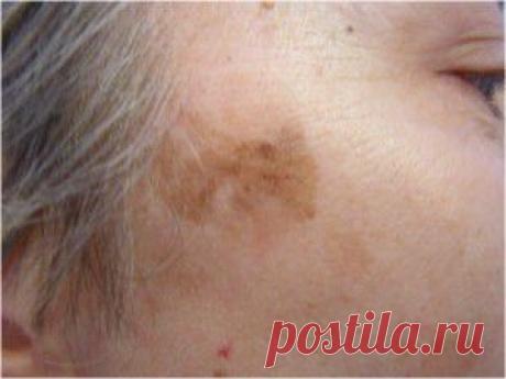 КАК ИЗБАВИТЬСЯ ОТ ТЛИ