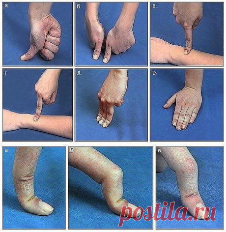 Массаж кисти руки.