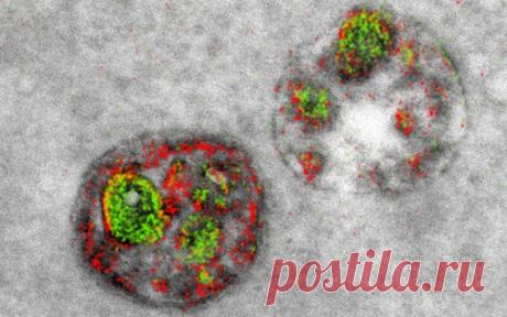 Получены первые цветные изображения, сделанные электронным микроскопом / Физика невозможного!