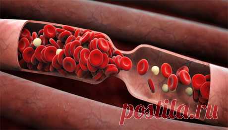 От тромбоза до тромбона – один шаг. 5 простых и надёжных советов, чтобы жить долго без тромбов. Интернет-магазин продукции для здоровья | Потребительское общество АРГО в Казахстане