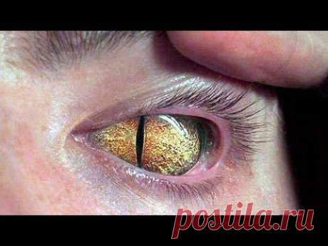 Рептилоиды среди нас. Reptiles among us