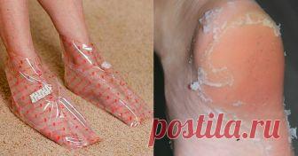 После того, как я нашла этот рецепт, я больше не экспериментирую, это средство подходит мне идеально! Грубая кожа на ногах – часто является результатом грибковых инфекций, отсутствия питательных веществ в организме, ношения неудобных ботинок или какого-то нарушения в эндокринной системе.