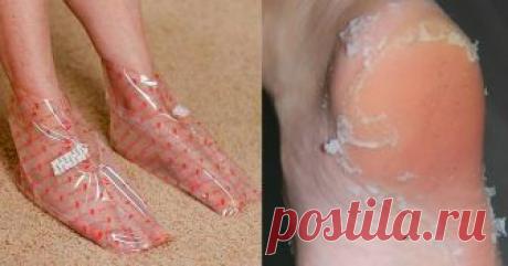 После того, как я нашла этот рецепт, я больше не экспериментирую, это средство подходит мне идеально! Грубая кожа на ногах – часто является результатом грибковых инфекций, отсутствия питательных веществ в организме, ношения неудобных ботинок или какого-то нарушения в эндокринной системе.