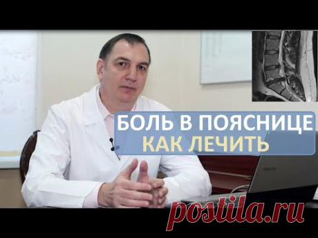 Острая боль в пояснице: как лечить. Грыжа диска, люмбаго, ишиас, радикулит.
