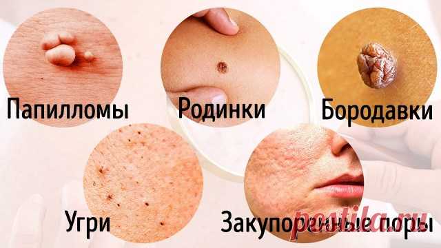 8 Серьезных Заболеваний, о Которых Говорит Наша Кожа — Копилочка полезных советов