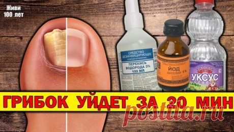 Как Избавиться от Грибка Раз и Навсегда Эффективный Способ Избавления от Грибка на ногах - смотреть онлайн в поиске Яндекса по Видео