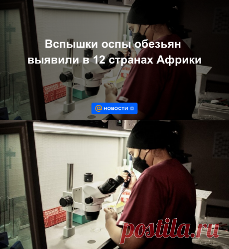 2-7-22-Вспышки оспы обезьян выявили в 12 странах Африки - Новости Mail.ru