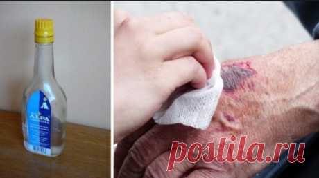 11 dôvodov, prečo by ste Alpu nemali pustiť z ruky. Máme ju doma takmer všetci a vôbec netušíme, čo všetko dokáže! Stará dobrá Alpa. Nechýba snáď v žiadnej domácnosti. Hoci všetci vieme, že je dobré mať ju po ruke, mnoho ľudí netuší, čo skutočne dokáže. Zozbierali sme pre vás 11 geniálnych tipov, ako využiť oby…