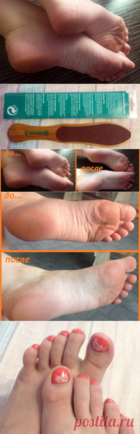 Как я делала педикюр в домашних условиях без замачивания в тазике - больше не переплачиваю в салонах (фото до-после) | Марина бренич | Яндекс Дзен