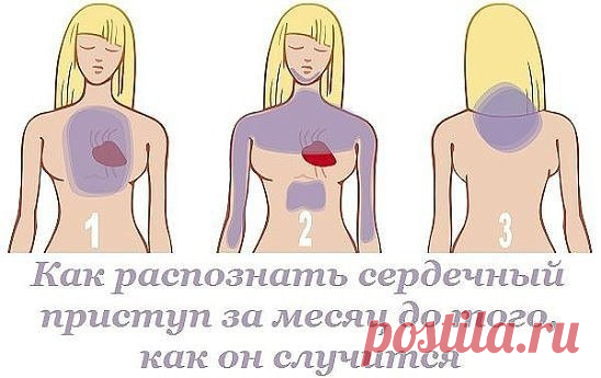 КАК РАСПОЗНАТЬ СЕРДЕЧНЫЙ ПРИСТУП ЗА МЕСЯЦ ДО ТОГО, КАК ОН СЛУЧИТСЯ