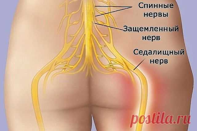 КАК РАЗБЛОКИРОВАТЬ СЕДАЛИЩНЫЙ НЕРВ
Как разблокировать седалищный нерв: 2 простых способа снять боль
Седалищный нерв свое начало берет в поясничном отделе позвоночника и, проходя через ягодицы, тянется к ступне. Поэтому боль при его защемлении чувствуется особенно сильно. 
Как правило, термин «защемление/ущемление седалищного нерва» подразумевает потерю эластичности и гибкости мышц задней поверхности ноги. Это часто связано с процессом возрастного укорочения (ригидности) мы...