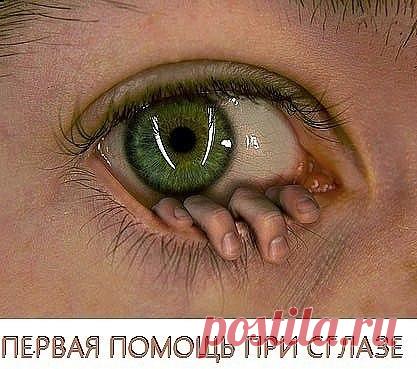 ПЕРВАЯ ПОМОЩЬ ПРИ СГЛАЗЕ
