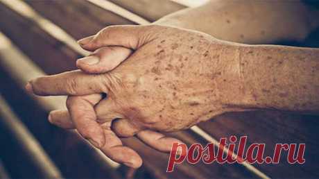 Почему на руках появляются старческие пятна — Journal women❜s