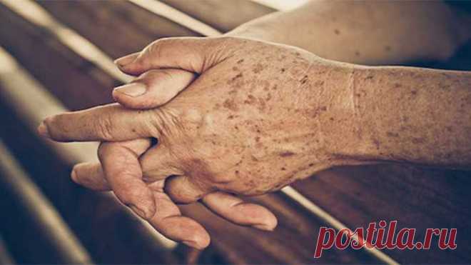 Почему на руках появляются старческие пятна — Journal women❜s
