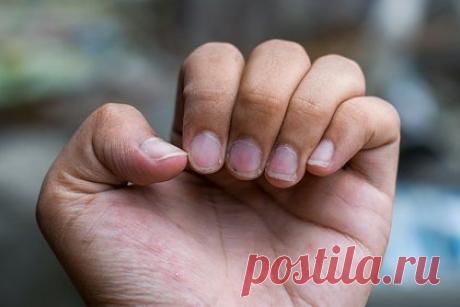 В Госдуме выступили за наказание мужчин за демонстрацию длинных ногтей. Демонстрация мужчинами длинных ногтей и волос, а также макияжа является нарушением общественного порядка и должна наказываться. Отдельно Хинштейн сообщил, что поводом для наказания за длинные ногти станет тот факт, что на улице и в других публичных местах их могут увидеть дети.