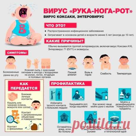 Вирус Коксаки 2017: симптомы, лечение и профилактика