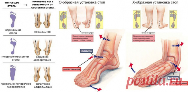 массаж стоп - Поиск в Google