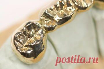 Кельты носили блестящие зубные импланты | Мир пристрастен