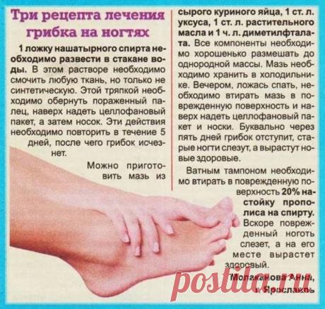 3 рецепта лечения грибка на ногтях