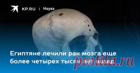 2024--Египтяне лечили рак мозга еще более четырех тысяч лет назад Frontiers Medicine: Рак мозга в Египте лечили 4,6 тыс лет назад