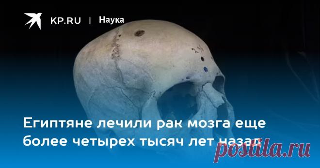 2024--Египтяне лечили рак мозга еще более четырех тысяч лет назад Frontiers Medicine: Рак мозга в Египте лечили 4,6 тыс лет назад