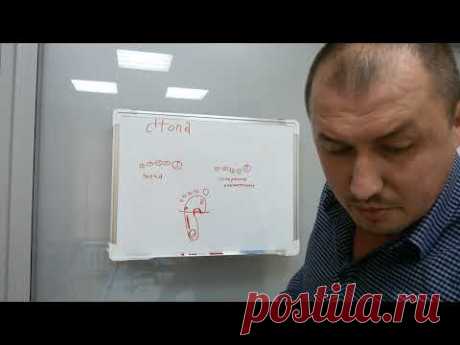 Боль в суставах стопы. Поперечное плоскостопие.