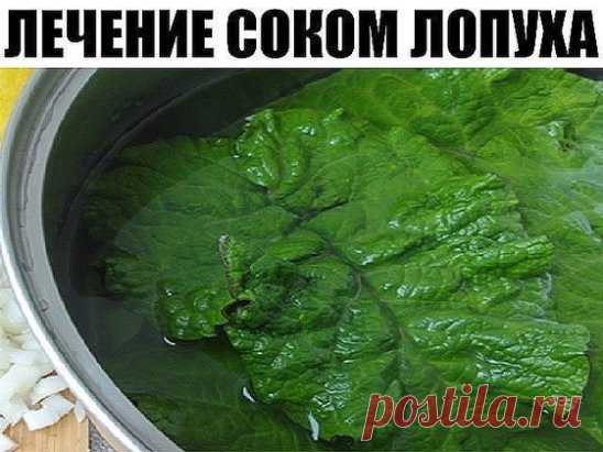 Лечение соком лопуха — старое проверенное средство
В народной медицине соком из свежих листьев лопуха успешно лечат разнообразные кисты. Лопух справляется с кистами на почках, кистами матки и яичников у женщин. Лечение соком лопуха длительное и требует дисциплины, зато, раз пролечившись этим средством, от кисты, как правило, удаётся избавиться навсегда и не прибегая к хирургическому вмешательству.
Лопух — старое проверенное средство. Перед его силой сдаются даже миомы, фибромы и другие новообр