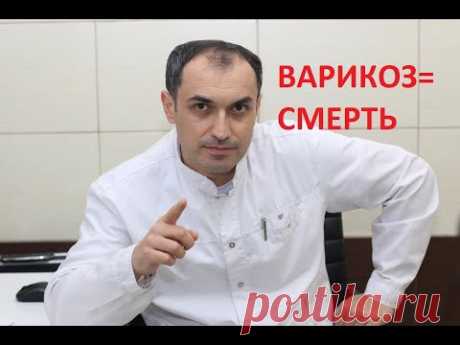 Самое опасное при варикозе. Флеболог. Москва.