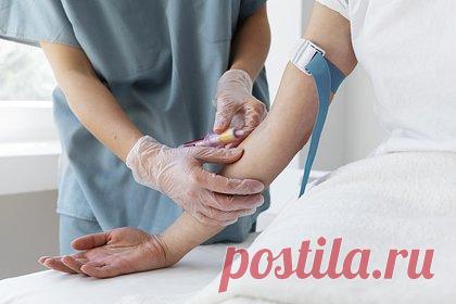 Перечислены ранние признаки сахарного диабета