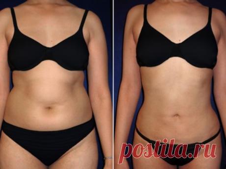 Эффективная диета от жира на животе: минус 15 кг за 30 дней в домашних условиях без упражнений и тренировок | Худеем вместе | Яндекс Дзен